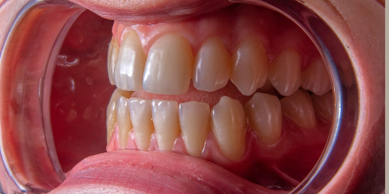 Ortodoncia invisible en Zafra: la forma más discreta y cómoda de corregir tu sonrisa